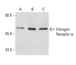 Estrogen Receptor alpha Antibody (AER314) - Western Blotting - Image 18127
