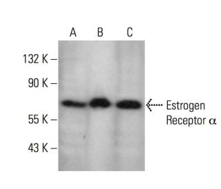 Estrogen Receptor alpha Antibody (C-311) - Western Blotting - Image 349302 