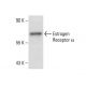Estrogen Receptor alpha Antibody (D547) - Western Blotting - Image 13441 