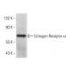 Estrogen Receptor alpha Antibody (D547) - Western Blotting - Image 14546