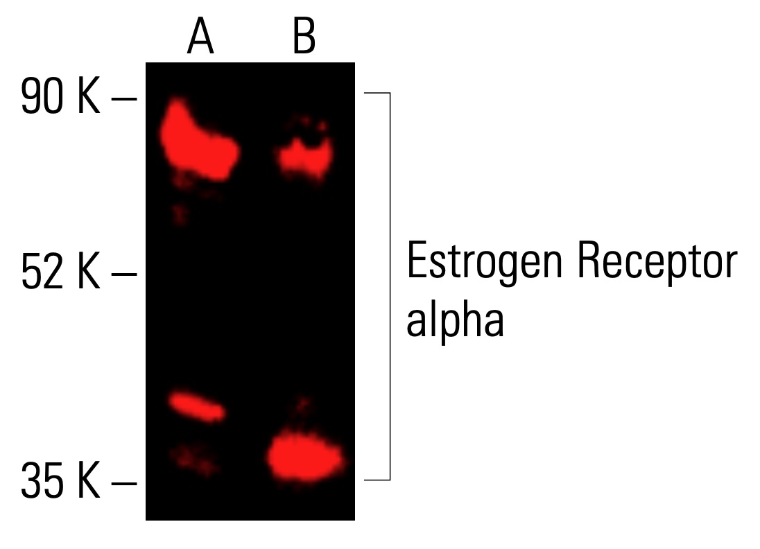 estrogen-receptor-alpha-