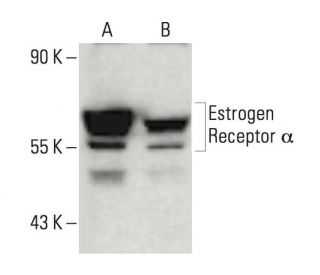 Estrogen Receptor alpha Antibody (H226) - Western Blotting - Image 139543 