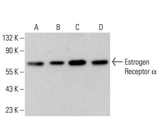 Estrogen Receptor alpha Antibody (2Q418) - Western Blotting - Image 374165