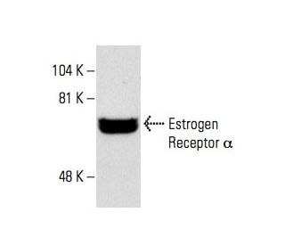 Estrogen Receptor alpha Antibody (D-12) - Western Blotting - Image 1593
