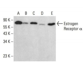 Estrogen Receptor alpha Antibody (C-311) - Western Blotting - Image 379713
