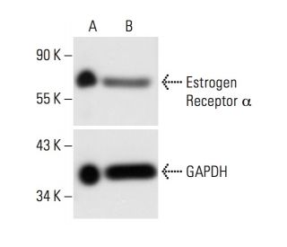 Estrogen Receptor &alpha; siRNA (h): sc-29305. Western blot analysis of Estrogen Receptor &alpha; expression in non-transfected contro 