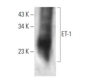 western blotting image from recommended Endothelin-1/EDN1/ET-1 (C7) monoclonal antibody replacement. Image 374566