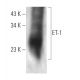 western blotting image from recommended Endothelin-1/EDN1/ET-1 (C7) monoclonal antibody replacement. Image 374566