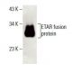 ETAR Antibody (C-4) - Western Blotting - Image 396359