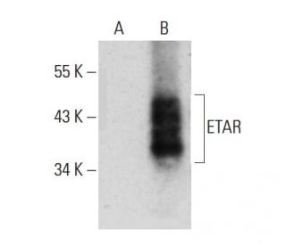 western blotting image from recommended ETAR (F-12) monoclonal antibody replacement. Image 384675