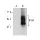 Dieser polyklonale Antikörper wird nicht mehr hergestellt. Wir empfehlen Ihnen unseren <a href="etar-antibody-f-12">ETAR (F-12)</a> monoklonalen Antikörper (Beispielsdaten werden angezeigt). western blotting image from recommended ETAR (F-12) monoclonal antibody replacement. Image 384675