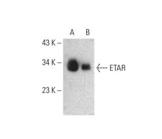 western blotting image from recommended ETAR (D-2) monoclonal antibody replacement. Image 391881