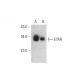 western blotting image from recommended ETAR (D-2) monoclonal antibody replacement. Image 391881