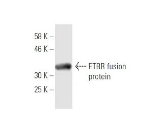 western blotting image from recommended ETBR (5H2) monoclonal antibody replacement. Image 348471