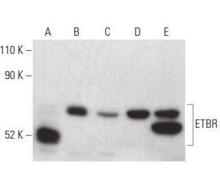 ETBR Antibody (C-5) - Western Blotting - Image 399643The Double Nickase Plasmid features a U6 promoter for sgRNA expression, a 20 nt targeting sequence, and a gRNA scaffold to guide Cas9n. It includes a CBh promoter for Cas9n (D10A) and puromycin resistance, GFP for transfection verification, and nuclear localization signals (NLS). The 2A peptide allows co-expression of Cas9n and Puro from a single promoter, enabling precise genome editing with reduced off-target effects.