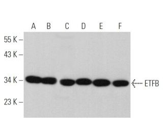 ETFB Antibody (E-10) | SCBT - Santa Cruz Biotechnology