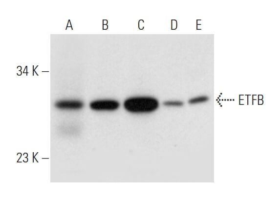 ETFB Antibody (F-1) | SCBT - Santa Cruz Biotechnology