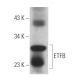 ETFB Antibody (F-1) - Western Blotting - Image 367520 