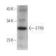 ETFB Antibody (F-1) - Western Blotting - Image 367566