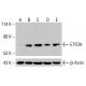 ETFDH Antibody (D-2): sc-515202. Western blot analysis of ETFDH expression in untreated HeLa (A), chemically-treated HeLa (B, C), K-562 (D) and HCT-116 (E) whole cell lysates. β-Actin (C4): sc-47778 used as loading control. Detection reagent used: m-IgG Fc BP-HRP: sc-525409. ETFDH Antibody (D-2) - Western Blotting - Image 415890