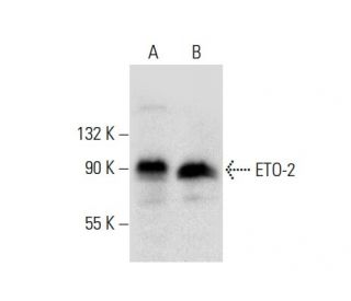western blotting image from recommended ETO-2 (C-12) monoclonal antibody replacement. Image 303850