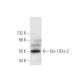 western blotting image from recommended Ets-1/Ets-2 (D-7) monoclonal antibody replacement. Image 305621