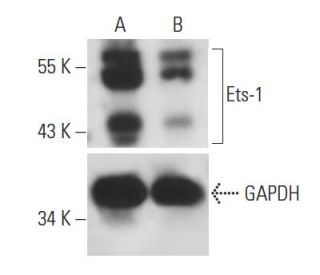 Ets-1 siRNA (h): sc-29309. Western blot analysis of Ets-1 expression in non-transfected control (A) and Ets-1 siRNA transf 