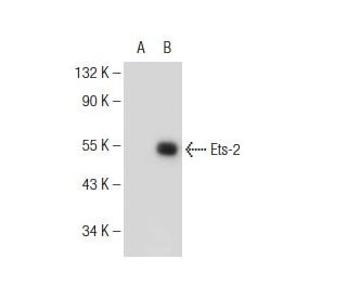 Ets-2 Antibody (F-4) - Western Blotting - Image 146784Each CRISPR/Cas9 Knockout (KO) Plasmid product consists of a pool of 3 plasmids designed to ensure identification and cleavage of a specific gene for maximum knockout efficiency. Each plasmid encodes a unique 20 nt sequence derived from the GeCKO (v2) library.