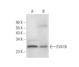 EVA1B Antibody (H-6) - Western Blotting - Image 305623
