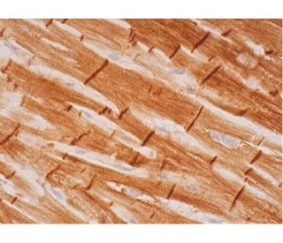 EVC Antibody (C-6) - Immunohistochemistry - Image 293486 