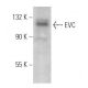 EVC Antibody (C-6) - Western Blotting - Image 369429
