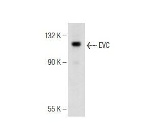 EVC Antibody (H-1) - Western Blotting - Image 146580 
