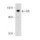 EVC Antibody (H-1) - Western Blotting - Image 146580 