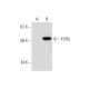 EVI5L Antibody (G-7) - Western Blotting - Image 291012