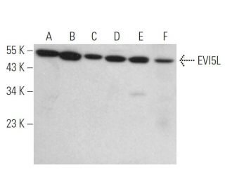 EVI5L Antibody (G-7) - Western Blotting - Image 373460 