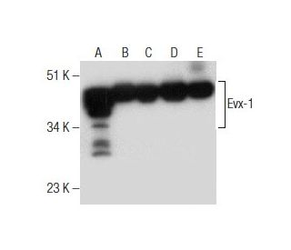 Evx-1 Antibody (397.3) - Western Blotting - Image 160655Each CRISPR/Cas9 Knockout (KO) Plasmid product consists of a pool of 3 plasmids designed to ensure identification and cleavage of a specific gene for maximum knockout efficiency. Each plasmid encodes a unique 20 nt sequence derived from the GeCKO (v2) library.