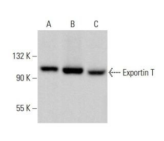 Exportin T Antibody (LOS1) - Western Blotting - Image 378693 