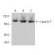 Exportin T Antibody (LOS1) - Western Blotting - Image 378687 