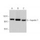 Exportin T Antibody (LOS1) - Western Blotting - Image 378693 