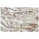 EY-cadherin Antibody (YB.2) - Immunohistochemistry - Image 35887