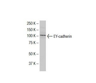 EY-cadherin Antibody (YB.2) - Western Blotting - Image 33441Each CRISPR/Cas9 Knockout (KO) Plasmid product consists of a pool of 3 plasmids designed to ensure identification and cleavage of a specific gene for maximum knockout efficiency. Each plasmid encodes a unique 20 nt sequence derived from the GeCKO (v2) library. 