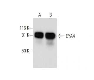 EYA4 Antibody (E-11) - Western Blotting - Image 292087Each CRISPR/Cas9 Knockout (KO) Plasmid product consists of a pool of 3 plasmids designed to ensure identification and cleavage of a specific gene for maximum knockout efficiency. Each plasmid encodes a unique 20 nt sequence derived from the GeCKO (v2) library. 