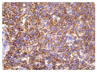 Ezrin Antibody (3C12) | SCBT - Santa Cruz Biotechnology Ezrin Antibody (3C12) | SCBT - Santa Cruz Biotechnology