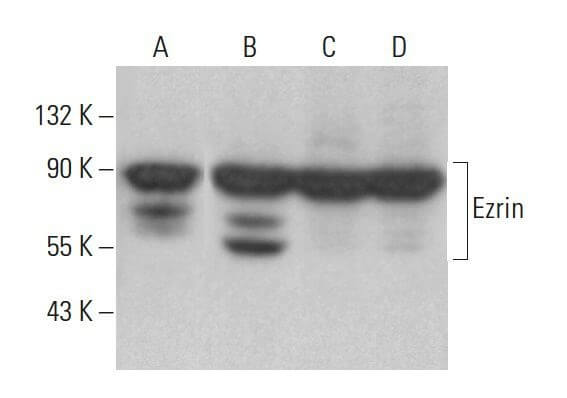Ezrin Antibody (3C12) | SCBT - Santa Cruz Biotechnology Ezrin Antibody (3C12) | SCBT - Santa Cruz Biotechnology