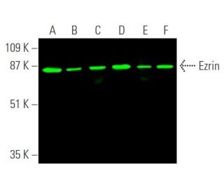 Ezrin Antibody (3C12) - Western Blotting - Image 375268