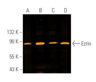 Ezrin Antibody (3C12) | SCBT - Santa Cruz Biotechnology Ezrin Antibody (3C12) | SCBT - Santa Cruz Biotechnology