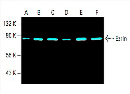 Ezrin Antibody (3C12) | SCBT - Santa Cruz Biotechnology Ezrin Antibody (3C12) | SCBT - Santa Cruz Biotechnology