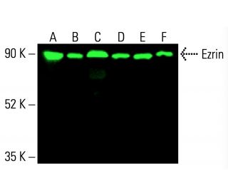 ezrin-antibody-3c12-western-