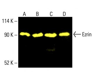 ezrin-antibody-3c12-western-
