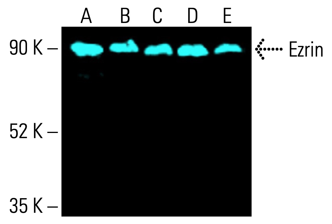 ezrin-antibody-3c12-western-